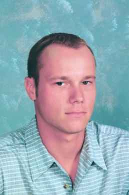 לפני מילוי מפרצים ושיער דליל